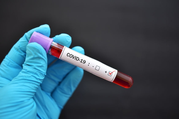 covid-19_blood_123.jpg