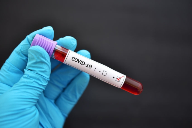 covid-19_blood_123.jpg